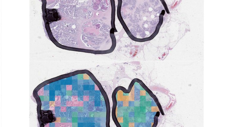 Image information can be used to predict the molecular classification of patient tumour samples in colour, using state-of-the-art deep learning models in pathology