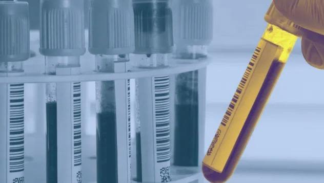 Various blood samples in test tubes.jpg